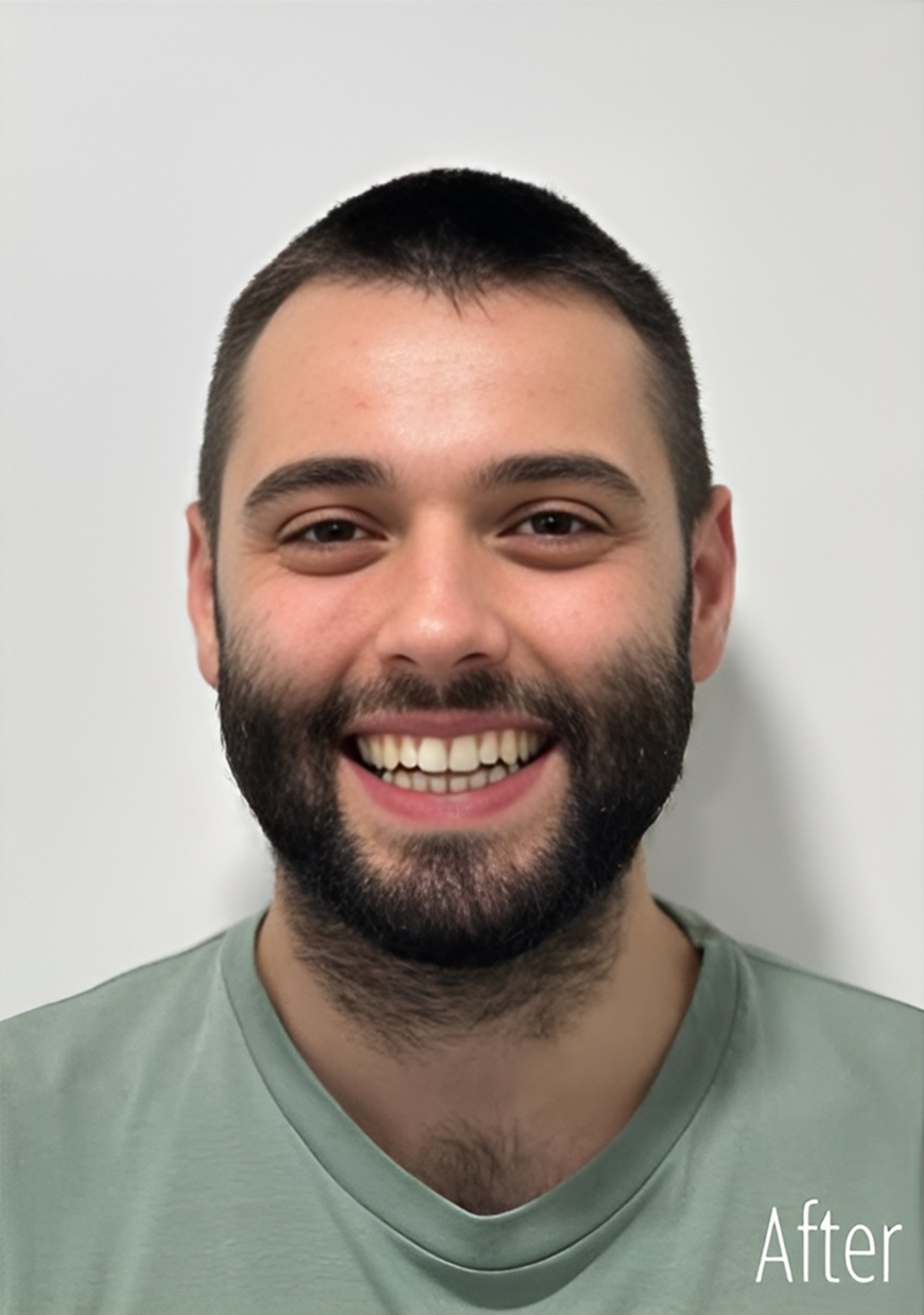 After Dental Treatment
